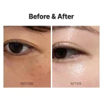 کرم روشن‌کننده ویتا تونینگ + دستگاه لیزر مدی‌تراپی - Image 9